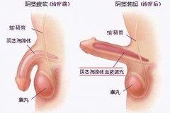 导致勃起障碍的原因是什么