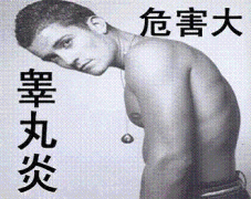 邢台男性睾丸炎的三种症状