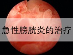 邢台男性膀胱炎的危害有哪些?