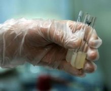 男人精子发黄是怎么了?