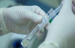 邢台死精症的检查方法