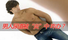 尿道炎应该如何治疗?