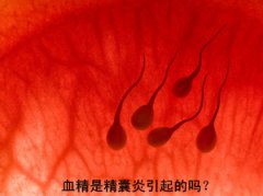 精囊炎原因有哪些?