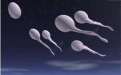 如何治疗精子畸形？