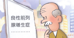前列腺钙化到底是怎么回事