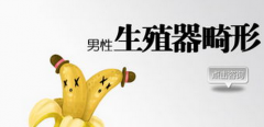 外生殖器畸形治疗费用一般是多少