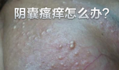邢台阴囊炎有哪些病因