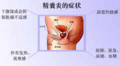 邢台男性精囊炎的饮食疗法