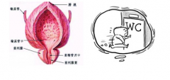 男性朋友们要做好前列腺囊肿的预防