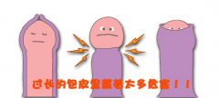 邢台包皮过长术后要怎么处理