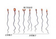 邢台少精弱精症如何治疗