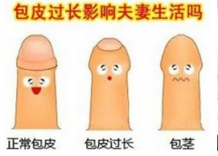 邢台包皮过长都有哪些类型