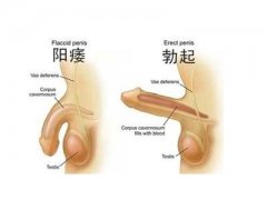 邢台治疗男性阳痿费用是多少贵吗